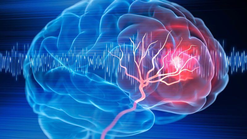 آیا سکته مغزی خطرناک است؟
